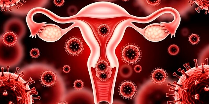vaginose bactérienne - Infection utérus